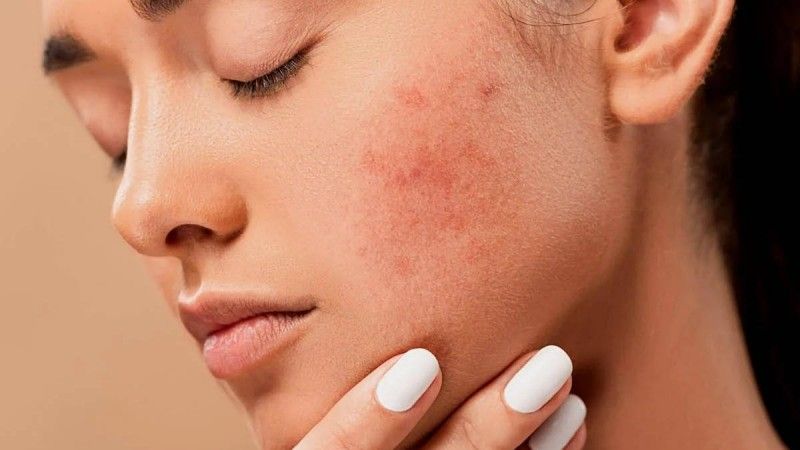 How to avoid skin sensitivity caused by cosmetics